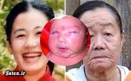 زایمان عجیب زایمان بیماری نادر بیماری عجیب اخبار چین