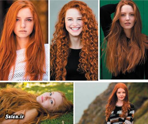 مجله سلامت علت قرمز شدن موی سر عجیب ترین ها دانستنی های علمی دانستنی های جالب پزشکی خصوصیات مو قرمزها انسان عجیب