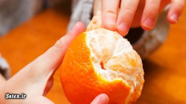 نارنگی چه ویتامینی دارد مضرات نارنگی مضرات میوه ها مجله سلامت متخصص تغذیه سلامت نیوز خواص نارنگی خواص میوه ها بهترین متخصص تغذیه