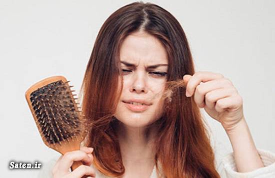 کچل شدن سر علت ریزش مو چیست سلامت نیوز سلامت مو دلایل ریزش مو در طب سنتی درمان فوری یبوست درمان ریزش مو
