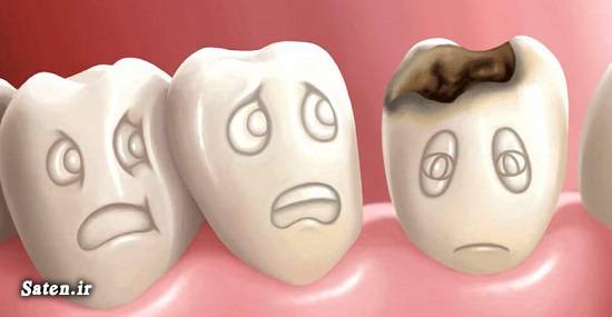 مجله سلامت کلینیک دندانپزشکی عوارض عفونت دندان برای بدن علایم عفونت دندان و لثه سپسیس چیست رعایت بهداشت دهان و دندان چگونه عفونت دندان را درمان کنیم تازه های دندانپزشکی