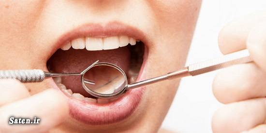 مشکلات دهان و دندان علت زخم های دهان و زبان سلامت نیوز زخم های دهان و زبان زخم دهان رعایت بهداشت دهان و دندان بهداشت دهان و دندان ارتودنسی