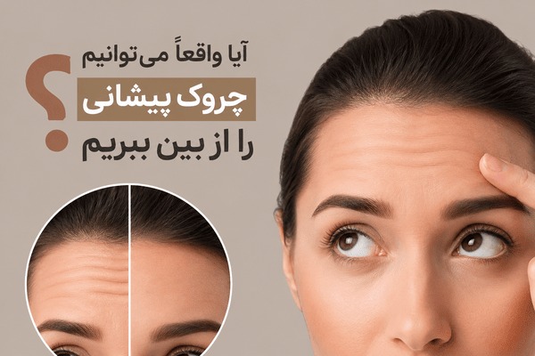 آیا واقعاً میتوانیم چروک پیشانی را از بین ببریم؟