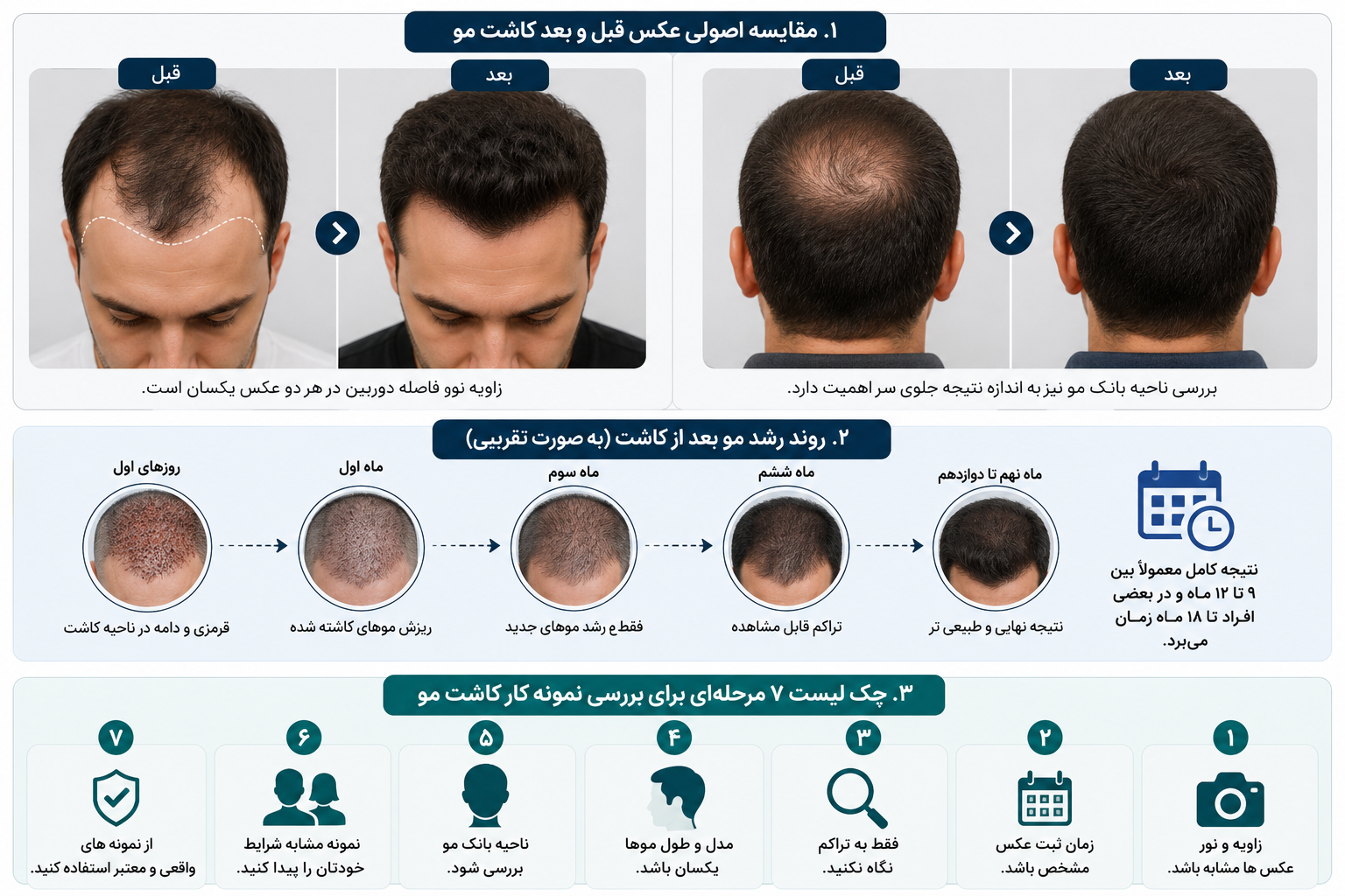 قبل از اعتماد به عکس‌های کاشت مو، این ۷ نکته را بررسی کنید