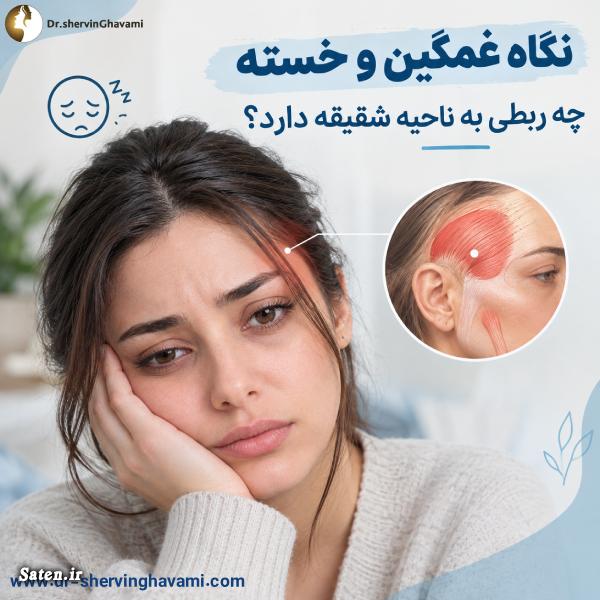 نگاه غمگین و خسته چه ربطی به ناحیه شقیقه دارد؟ نگاه غمگین و خسته چه ربطی به ناحیه شقیقه دارد؟